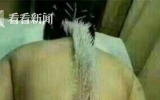 中医恶搞视频，中医恶搞视频下载